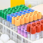Ricerca scientifica, medicina, provette, laboratorio medico